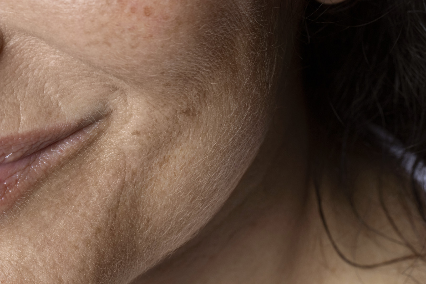 PRP behandeling voor huid en haar PRP behandeling voor huid en haar